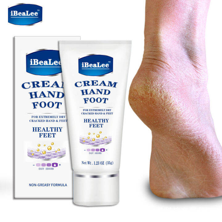 IBeaLee Foot Cream Antifreeze Cream Repairs Dry, Skinny, Rough, and ...