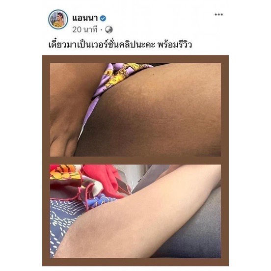 me-white-cream-ครีมทาง่ามขาแอนนา-ศอกดำ-ครีมแอนนา