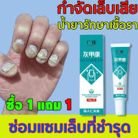 ฆ่าเชื้อราที่เล็บ 20g ซรั่มรักษาเล็บ ซ่อมเล็บที่ชำรุด เชื้อราเล็บ ครีมบำรุงเล็บ ยาฆ่าเชื้อราเล็บ น้ำยารักษาเชื้อรา