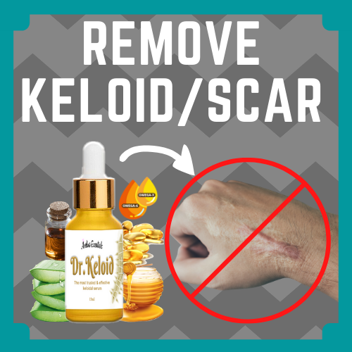 Dr Keloid Keloid Scar Remover Original Keloid Remover Keloids