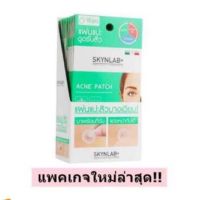 แผ่นแปะดูดซับสิว SKYNLAB+ แผ่นแปะสิว