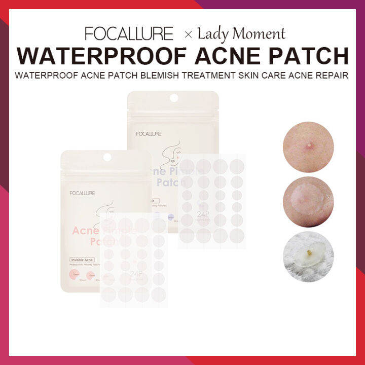 Focallure Waterproof Acne Patch Blemish Treatment Skin Care Acne Repair Lazada Ph