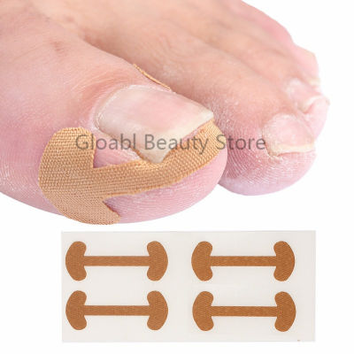 28Pcs Ingrown Toenail Corrector สติกเกอร์ Self-Adhesive Paronychia Treatment Fixer Recover Corrector Bunion Pedicure Toe Nail Care