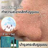 AOPY สูตรอ่อนโยน กำจัดสิวหัวดำ 3 in 1 Set ลบสิวหัวดำและสิว บำรุงกระชับรูขุมขน ขจัดผิวที่ตายแล้ว ผิวกระจ่างใส ครีมลอกสิวเสี้ยน ลอกสิวหัวดำ สิวอุดตัน ลอกได้ทั้งหน้า สูตรใหม่ สำหรับคนเป็นสิว และผิวแพ้ง่าย ( ที่ลอกสิวเสี้ยน ลอกสิวเสี้ยน มาร์คหน้าสิวเสี้ยน)