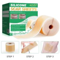 ALIVER 4x150cm Efficient Surgery Scar Removal Silicone Gel Sheet Therapy Patch Acne Trauma Burn Scar Skin Repair Scar Treatment in stock