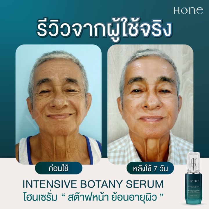 ของแท้-ส่งฟรี-เซรั่มหนุ่มกรรชัย-2ขวด-2เดือน-โฮนเซรั่ม-hone-intensive-botany-serum-ไฮยาฟิลเลอร์-โบท็อกซ์-ยกกระชับผิว-เซรั่มผิวหน้า-ลดร่องแก้ม