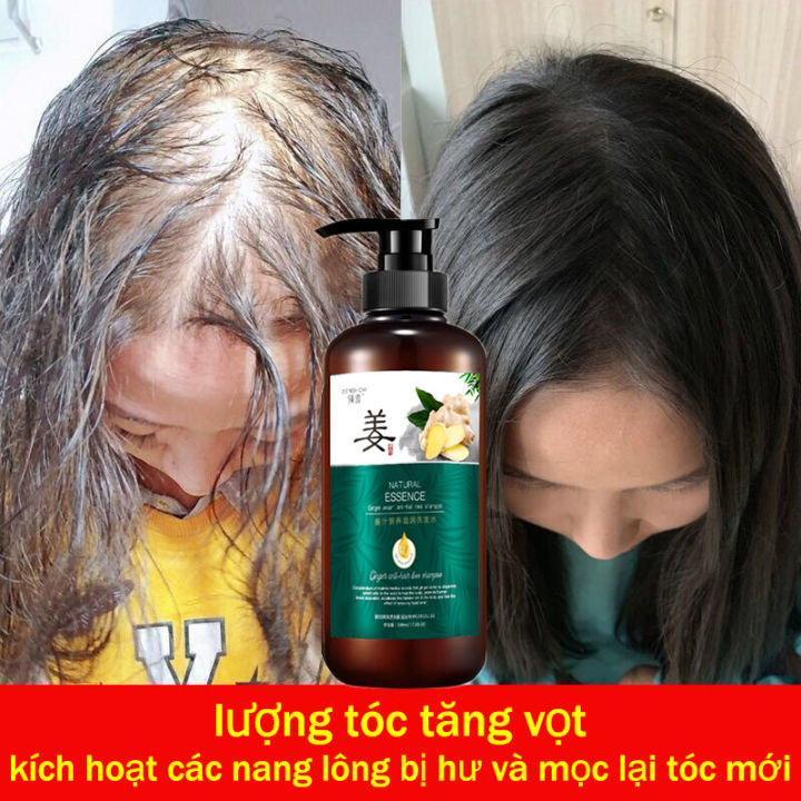 Terapic Combo kích mọc tóc và dầu gội giảm rụng tóc ưu đãi 10 sản phẩm của  Hàn Quốc  Shopee Việt Nam