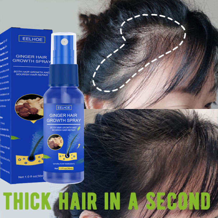 Fast Hair Growth Spray Prevent Baldness Hair Growth Serum Fast Powerful