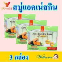 สบู่ สบู่แอคเน่สกิน สบู่อาบน้ำ Turmeric Soap สบู่ล้างหน้า สบู่ก้อน สบู่ธรรมชาติ Acne Skin Bar Soap 3 กล่อง