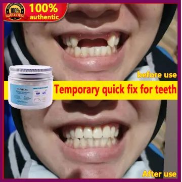 Temporary Tooth Repair Kit Teeth And Gaps False Teeth Solid Glue