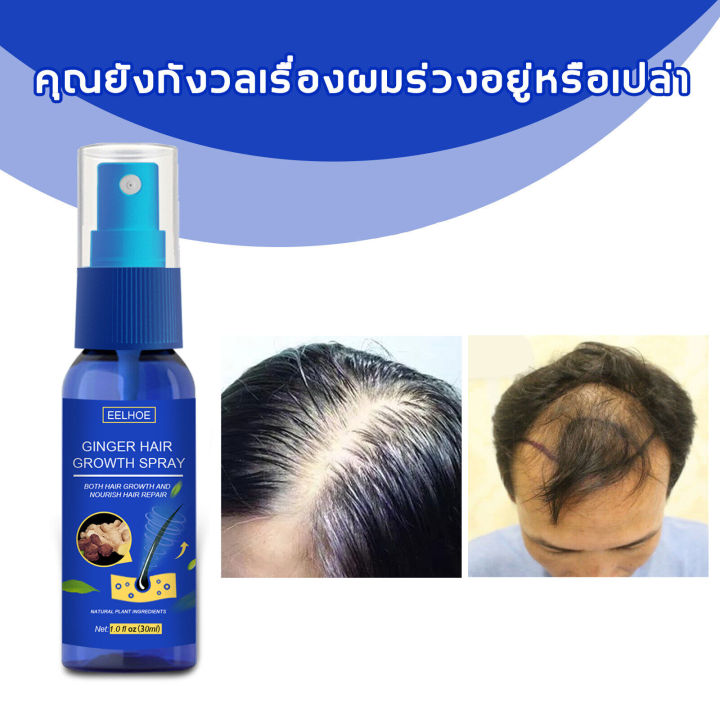 thai-พร้อมส่ง-eelhoe-สเปรย์ปลูกผม-เซรั่มปลูกผมดก-ปลูกผมหนา-ช่วยปรับปรุงผมร่วง-ป้องกันผมร่วง-เร่งการเจริญเติบโตของเส้นผม-เซรั่มปลูกผม-นํ้ายาปลูกผม-บำรุงผม-ปลูกผมเร่งด่วน-น้ำยาเร่งผมยาว-เซรั่มบำรุงผม-ยา