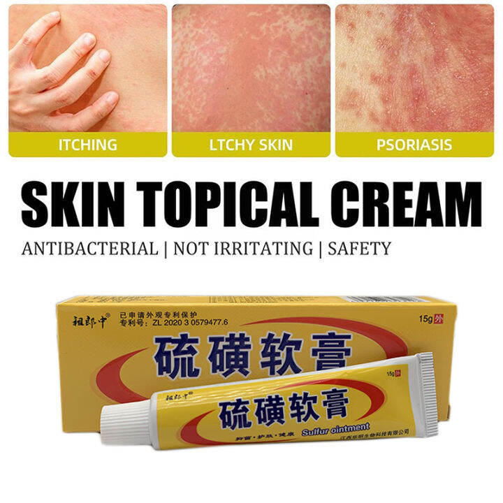 Sulphur Ointment Treatment Cream Psoriasis Eczema Itching Skin Allergy ...