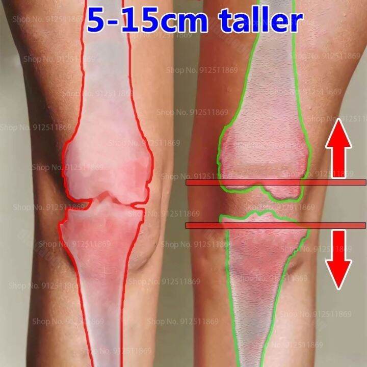 cw-natura-height-growth-promot-bone-growth-height-increasing-oil-second-increase-in-heigh-grow-essential-oil-body-height-5-15cm