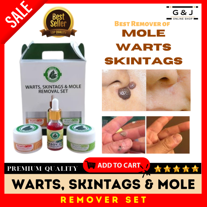 Pure Kasoy Removal Set Warts Skintags And Mole Remover Original Kasoy Oil With Healing