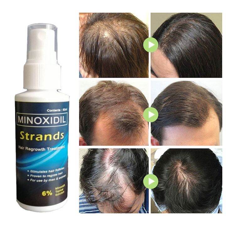 Minoxidil Strands 6 Topical Solution (60ml per bottle) Grower beard ...