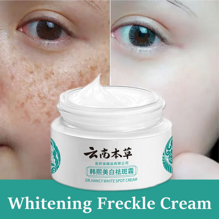 7 days Whitening Japanese Melasma Cream Yunnan Herbal Whitening Freckle