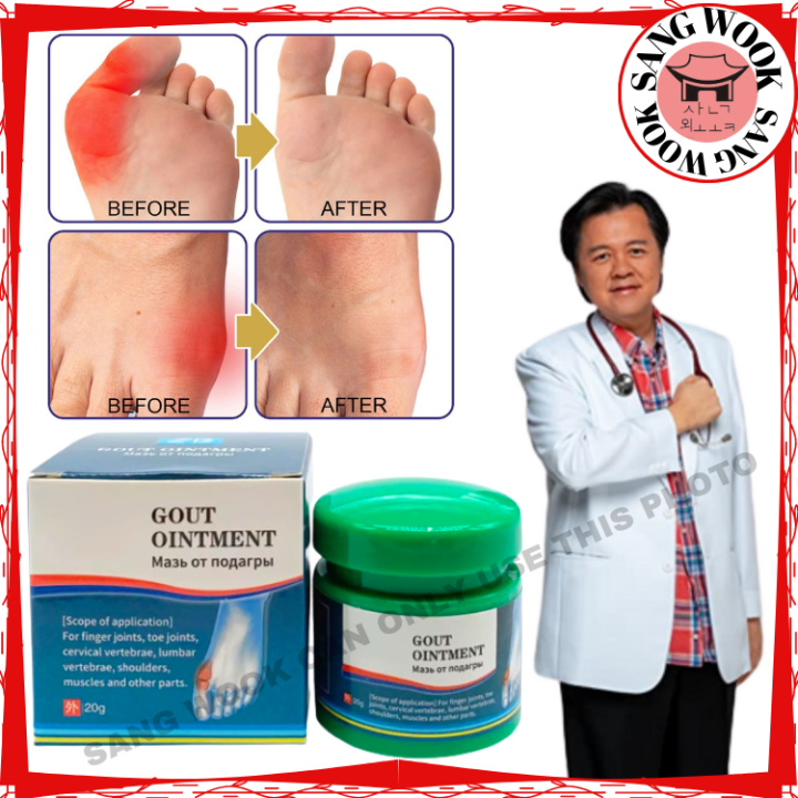 Gout Ointment Treatment Pain Killer Cream Joint Knees Toe Pain Gout