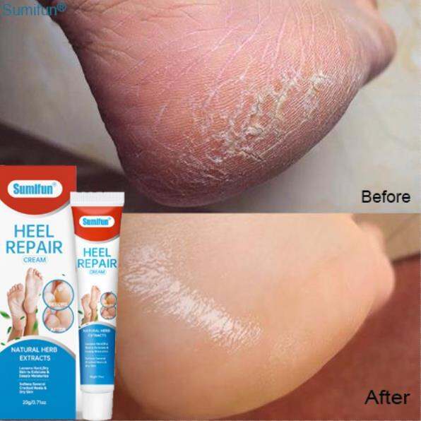 Sumifun Foot Cream/Hand Cream ourishes dry feet Deeply hydrates hands