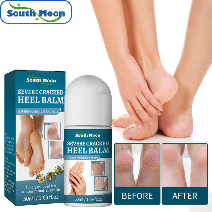South Moon Severe Cracked Heel Balm for Dry Cracked Feet Repair Stick