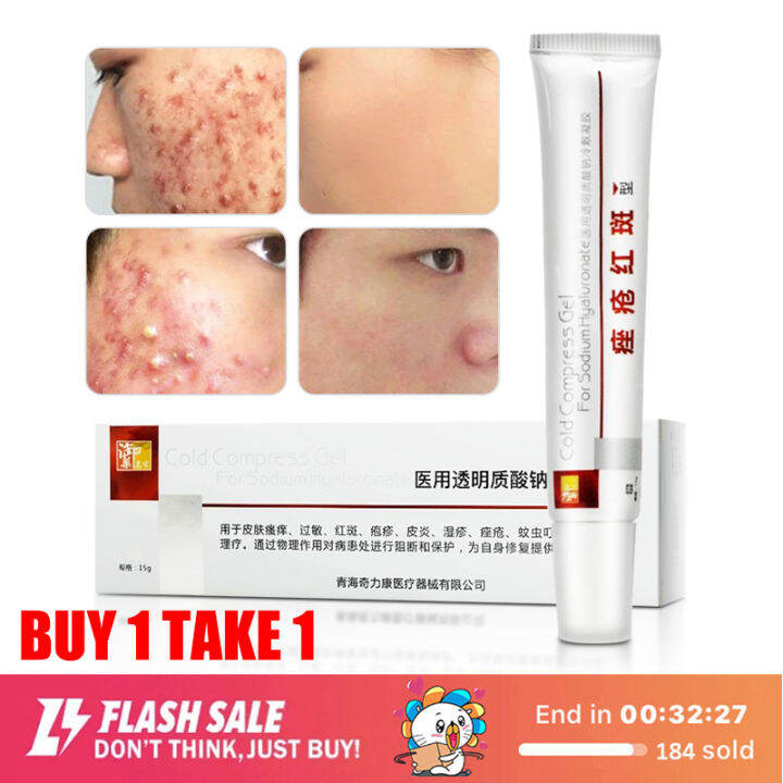 [BUY 1 TAKE 1] Anti Acne and Pimples Cream 15g Acne Scars Remover for ...