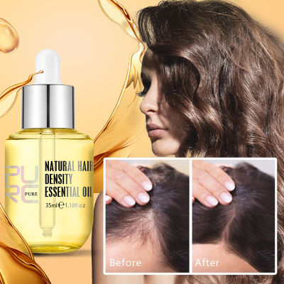 PURC Ginger Essentials Hair Growth Sprays ผลิตภัณฑ์สำหรับผู้ชายผู้หญิง Fast Regrowth Oil Hair Scalp Treatment Hair Grow Beauty Health