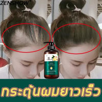 【พร้อมส่ง】ZENSHOW เซรั่มยาสระผมขิง แชมพูแก้ผมร่วง 500ml ทำความสะอาดผม ฟื้นฟูตัวเอง แชมพู（แชมพูขิงเพียว ยาสระผมขิง แชมพูขิง เซรั่มขิงบำรุงผม เซรั่มแก้ผมร่วง เซรั่มปลูกผม แชมพูปลูกผมดก แชมพูลดผมร่วง แชมพูสมุนไพร ผมร่วงผมบาง เซรั่มบำรุงผม