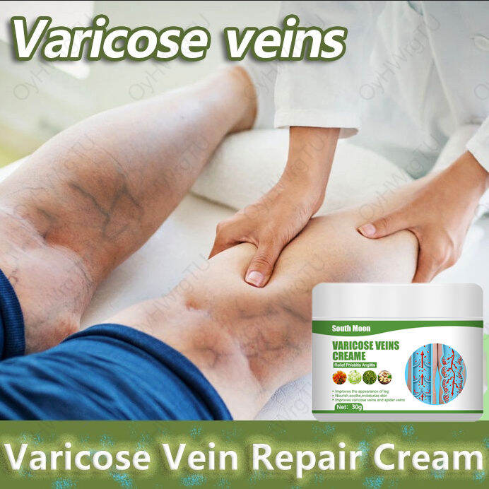 Skin Care Varicose Vein Repair Cream Varicose Vein Treatment 