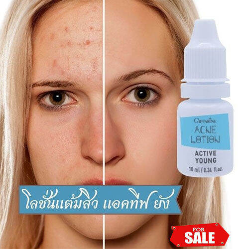 hot-sale-กำจัดสิวหน้าไม่พังด้วยกิฟฟารืนโลชั่นแต้มสิวแอคทิฟยัง-ปริมาณ-10-กรัม-1กระปุก-รหัส22101-lung-d-ของแท้100