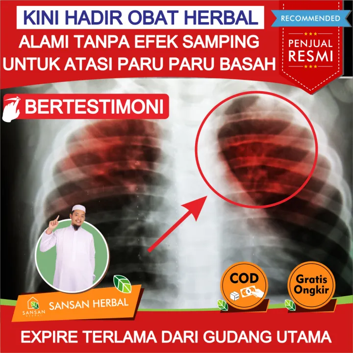 Obat infeksi paru-paru di apotik