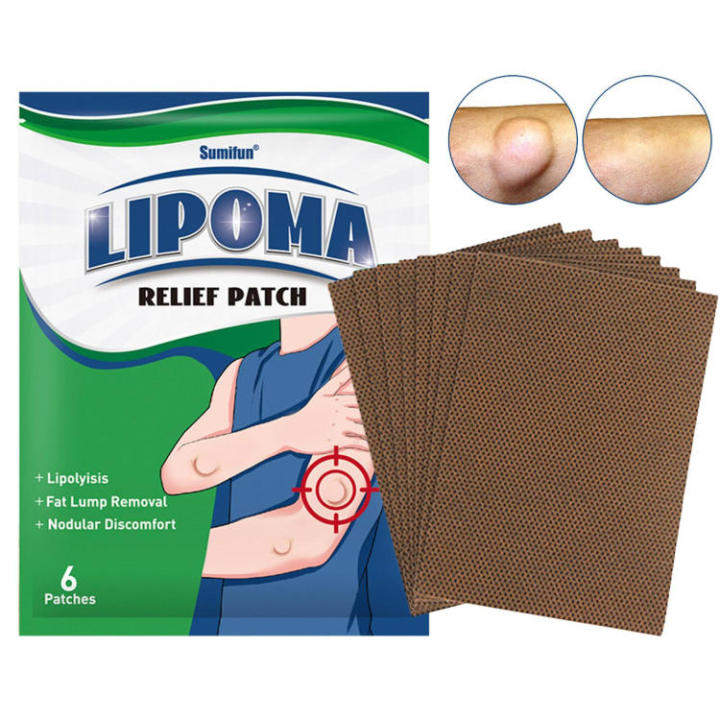 Lipoma Remover 6pcs Neck Lymph Node Anti-Swelling Lipoma Removal Patch ...