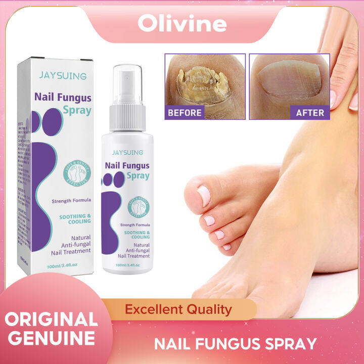 Jaysuing Nail Repair Spray Anti Infection Paronychia Onychomycosis 