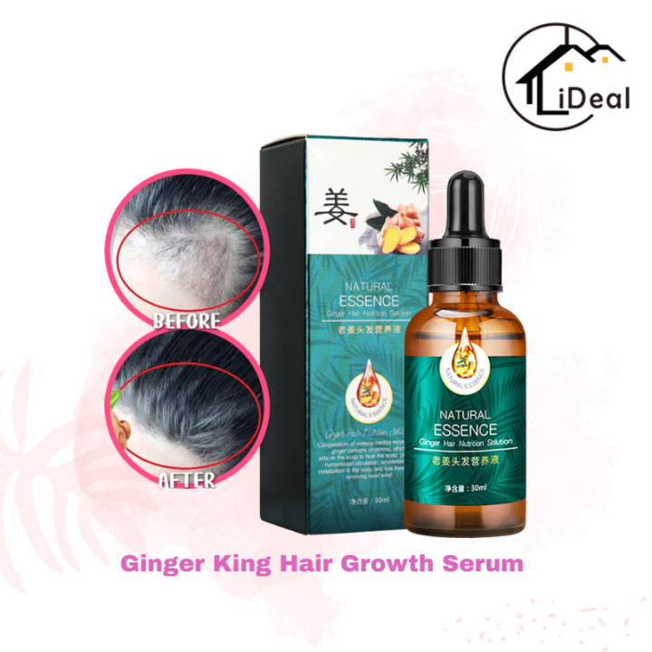 ⚡iDeal Home⚡Ginger King Hair Growth Serum ginger hair growth tonic