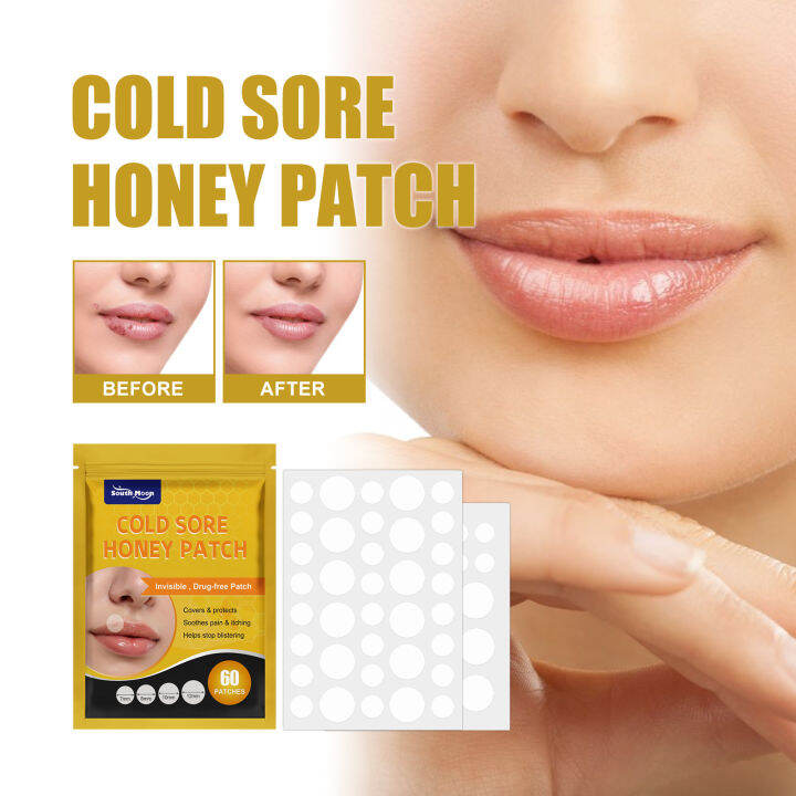 Mouth Blisters Sticker Contraction Relieving Perilip Granules ...