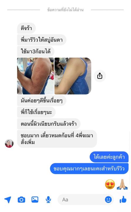 พร้อมส่ง-สบู่โสมน้ำผึ้ง-anda-โรคสะเก็ดเงิน-โรคผิวหนังคับ-กลากเกลื้อน-เชื้อรา-น้ำเหลืองเสีย-จบที่ก้อนเดียว-หายขาด