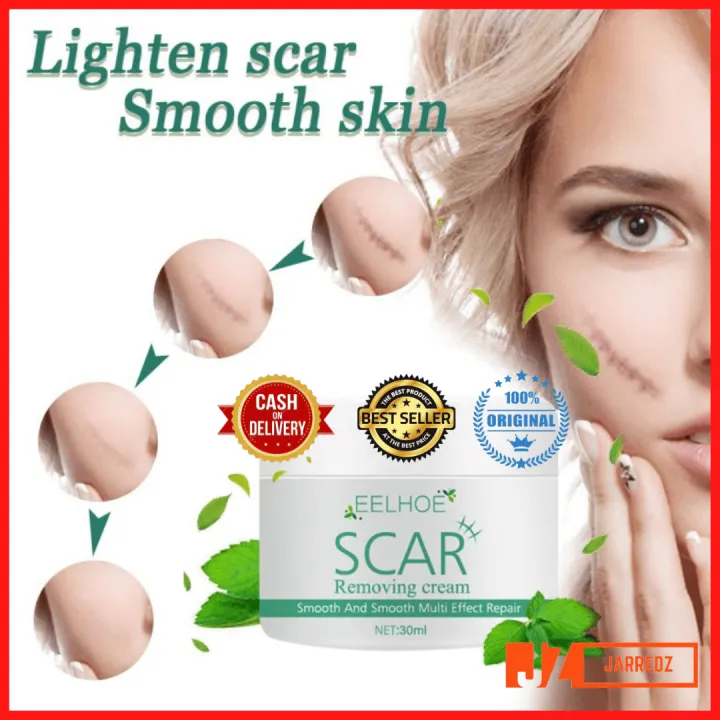 Eelhoe Scar Remover Cream 30ml For Old And New Scars Reduce And Repair Acne Scars Surgery Scar 0096