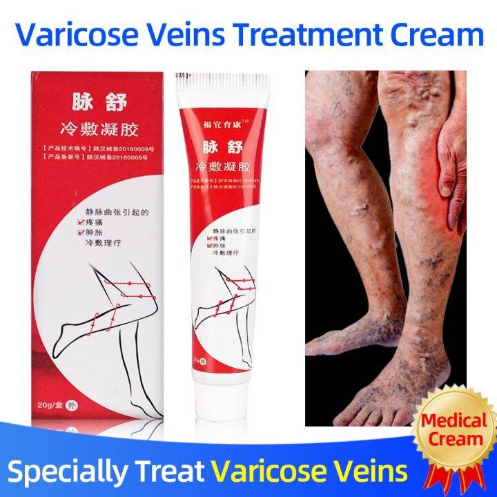 Vene Varicose Impacco Freddo Gel Flebiti/Vasculite Trattamento Unguento ...