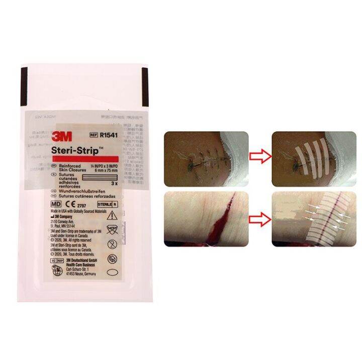 1 Bag Sterile Wound tape Skin Closure Strip Tape For Surgical Wound And