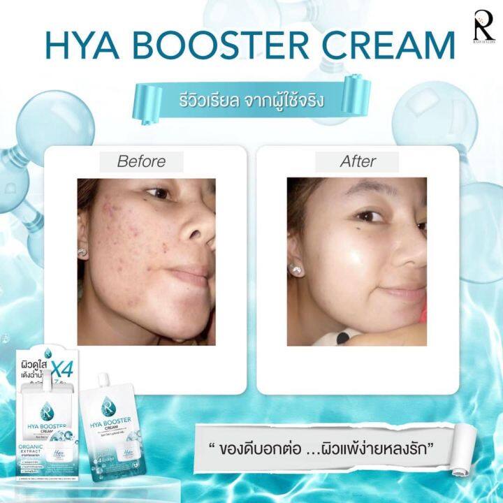 3ซอง-ครีม-ไฮยา-น้องฉัตร-hya-booster-cream-ผิวกระจ่างใส-ลดรอย-ดำ-รอยแดง-ผิวไหม้-แสบ-ผิวชุ่มชื้น-ขายดี-ใช้ดี-หน้าขาว-ผิวเด้ง