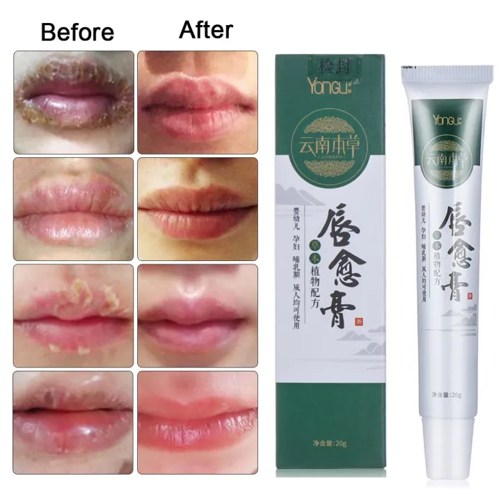 RUEL Anti Aging Moisturizing Lips Care AntiWrinkles Cold Sores Nourish