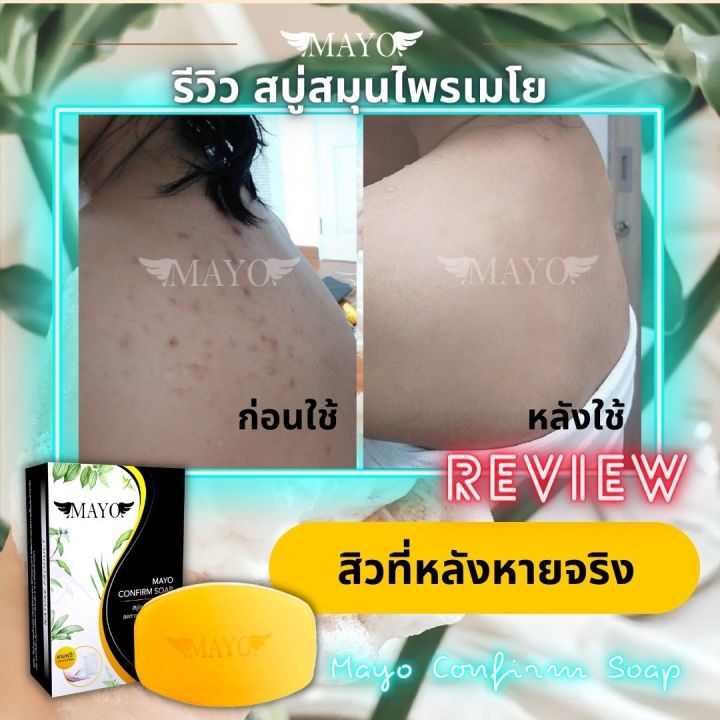 สบู่เมโย-สมุนไพร-ลดสิว-ผิวขาว-ซื้อ-10-แถม-2-คุ้มมาก-ใช้แล้วติดใจ-ผิวดีขึ้น-สิวยุบ-รูขุมขนกระชับ-mayo