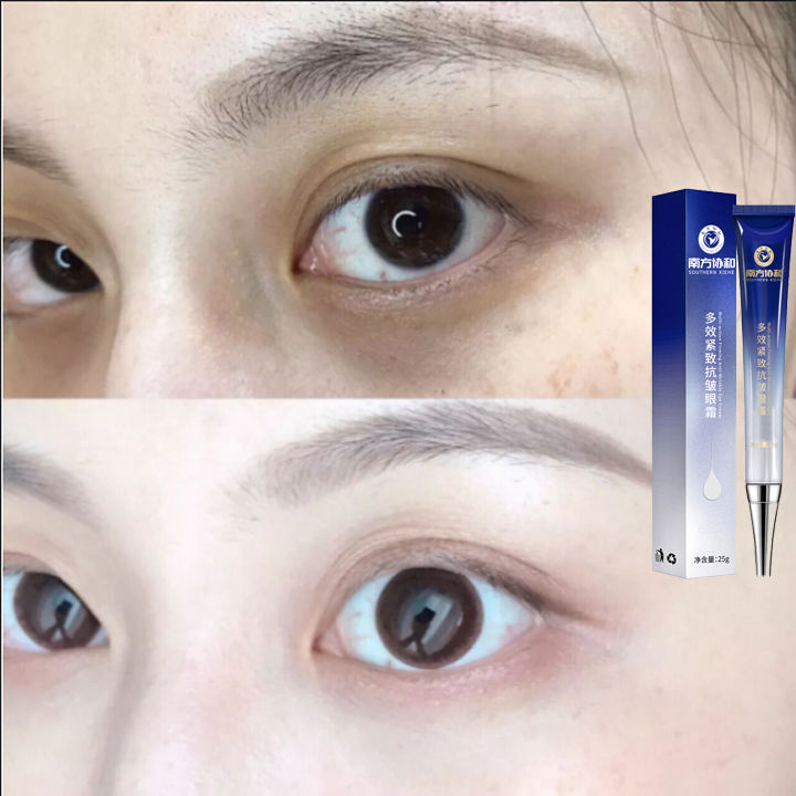 ครีมบำรุงรอบดวงตา-อายครีม-ต่อต้านริ้วรอย-ยกกระชับผิวรอบดวงตา-ลดใต้ตาดำ-anti-wrinkle-anti-aging-eye-cream-effectively-remove-dark-circles-puffiness-repair-eye-lifting-moisturizer-cream