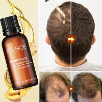 【cw】 Men Women Fast Growing Treatment Hair Loss Essence Hair Growth Serum Essential Care Oils Repair Dry Thinning Hair Products ！