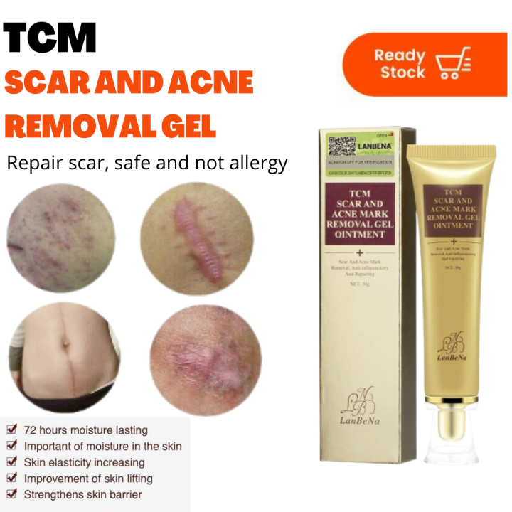 Lanbena Tcm Scar Removal Gel Acne Pimples Stretch Marks Keloid Remover Skin Repair Cream Spots 2847