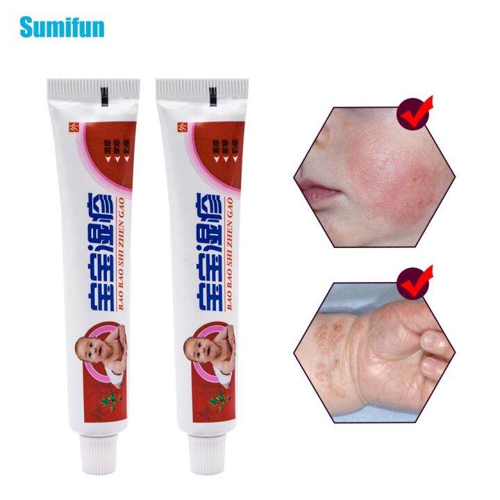 Sumifun Body Psoriasis Pruritus Eczema Dermatitis Cream Baby Itching