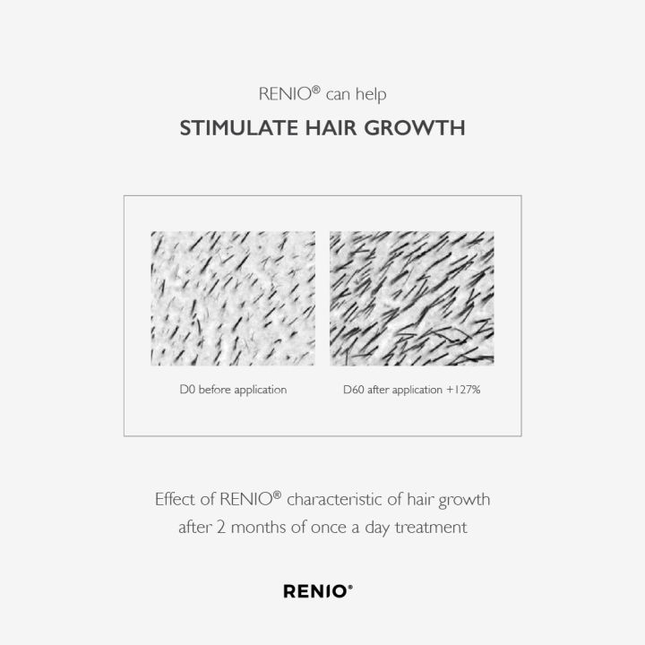 renio-specific-point-serum-for-hair-growth-30ml-เซรั่มปลูกผม-กระตุ้นผมขึ้นใหม่-หยุดผมร่วง-ผมบาง-หัวล้าน