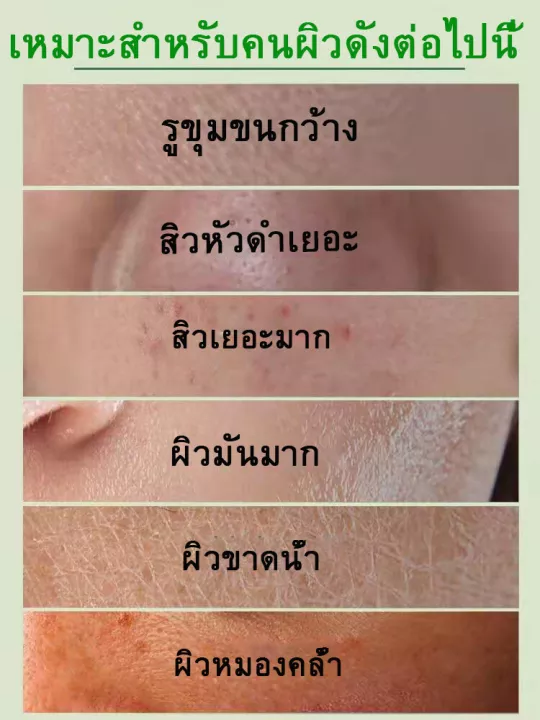 มาสก์โคลน-ชาเขียว-แบบแท่ง-สำหรับทำความสะอาดผิวหน้า-ดูแลผิวหน้า-กำจัดสิว-สิวหัวดำ-ควบคุมความมัน-สิว-ผิวชุ่มชื้น-กระจ่างใส