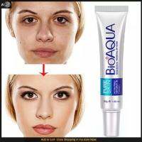 PIMPLES REMOVAL CREAM