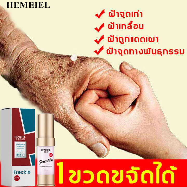 hemeiel-เซรั่มทาฝ้า-ครีมแก้ฝ้า-ลดฝ้ากระ-ซ่อมแซมผิวให้เรียบเนียนมากขึ้น