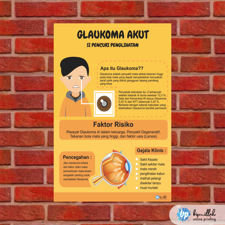 Poster Kesehatan Glaukoma Akut | Lazada Indonesia