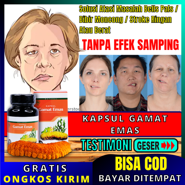 Obat Bells Palsy - Obat Bibir Miring Muka Mencong Sebelah Kanan / Kiri ...